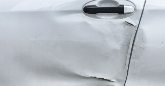 dented auto door